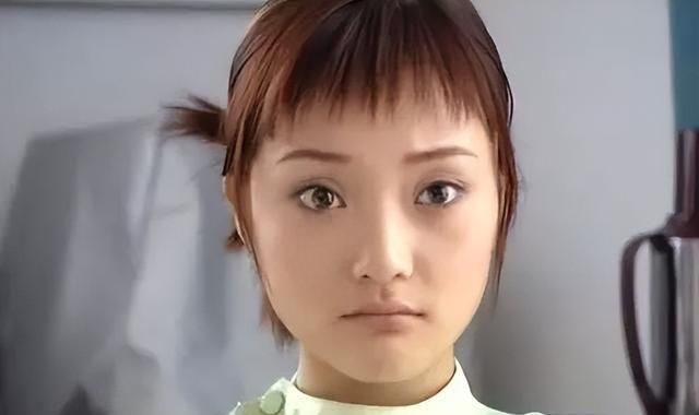 双眼皮别乱割，从景甜到戚薇，这些明星的“后遗症”出来了