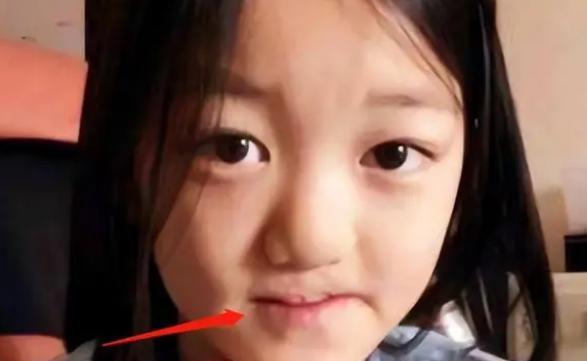 李亚鹏|李亚鹏晒全家福！1岁女儿嘴正常、眼睛疑斜视，网友喊话快去检查