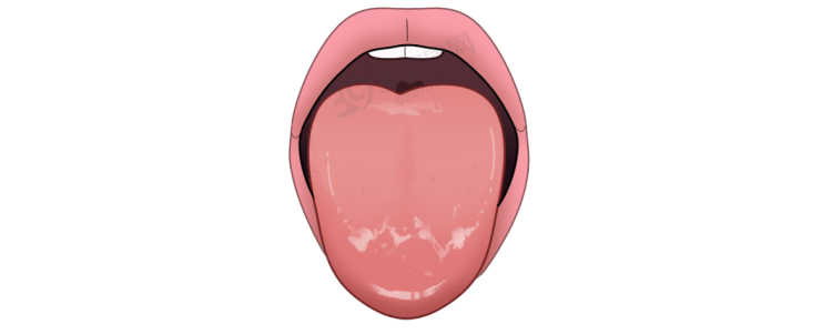 体内有癌,舌头先知?若舌头出现7种异常,当心癌症或疾病预警