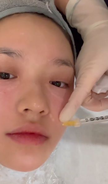 太真实!林允晒打水光针过程,画面高能,全程面不改色引争议