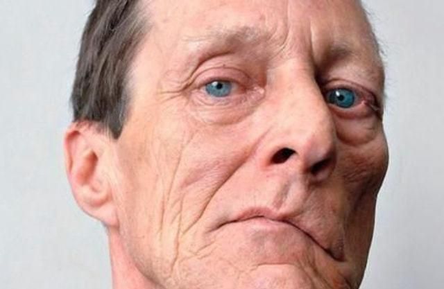 医生|寿命长的人,“相貌”通常有什么表现?若你占3个,提前说声恭喜