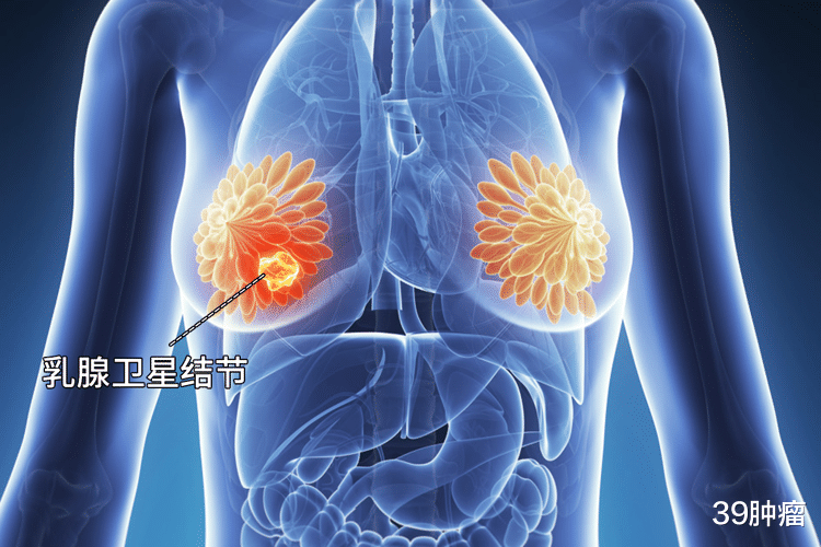 查出结节先别慌，管住嘴巴，少吃4种食物，结节有可能慢慢变小