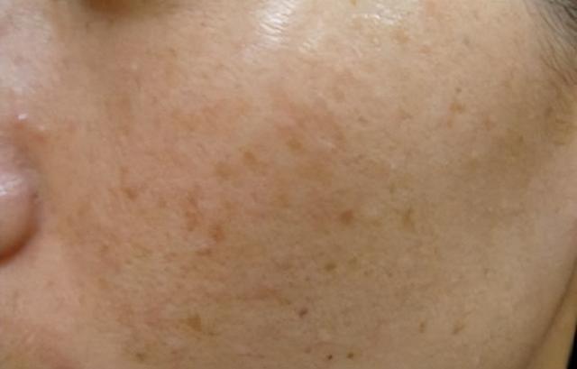 肤色暗沉，色斑丛生？这些方法让你轻松焕肤！