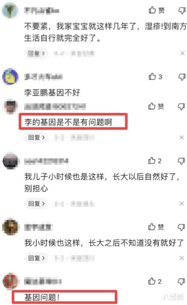 工藤静香|1岁女儿手指患病，李亚鹏被质疑基因有问题，海哈金喜主动揽责任