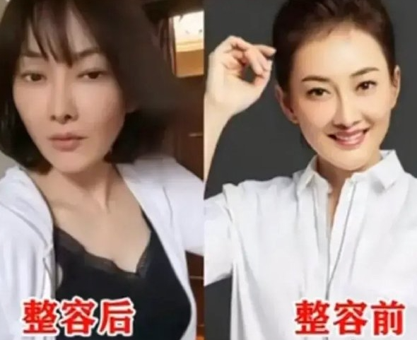 50岁牛莉整容!尖下巴朝天鼻网红脸,镜头凑近也太吓人了!