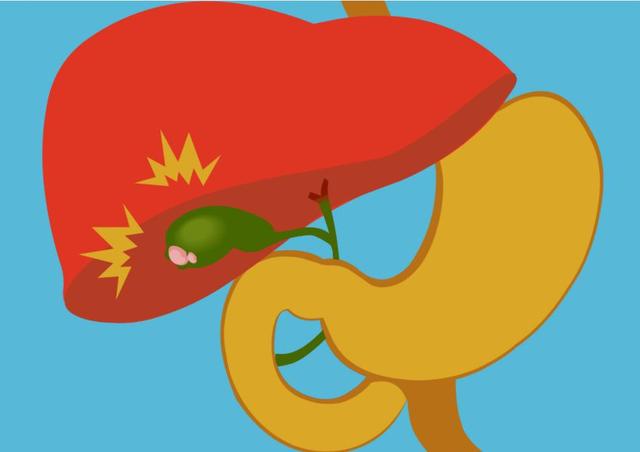 手术切除“胆囊”，会有哪些后遗症？医生说出真相，看完涨知识了