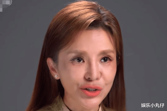 朱迅录节目被疑整容失败!面部坑洼出现黑斑,网友:央视没人了?