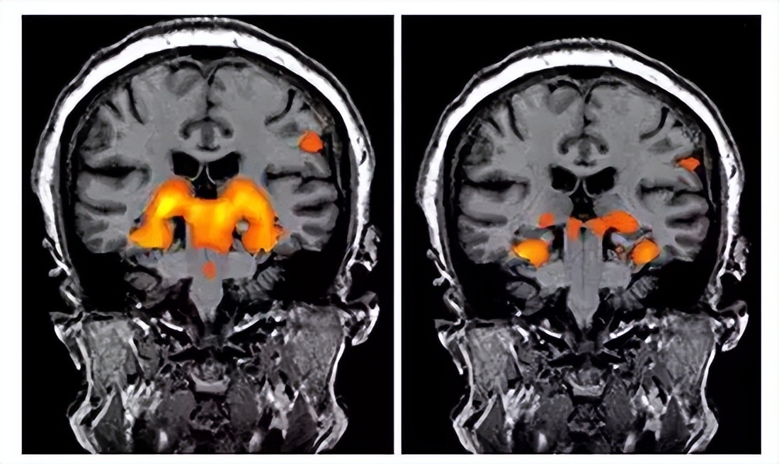 顶流vs顶流，当初鹿晗关晓彤官宣，也就这个炸度了吧！
