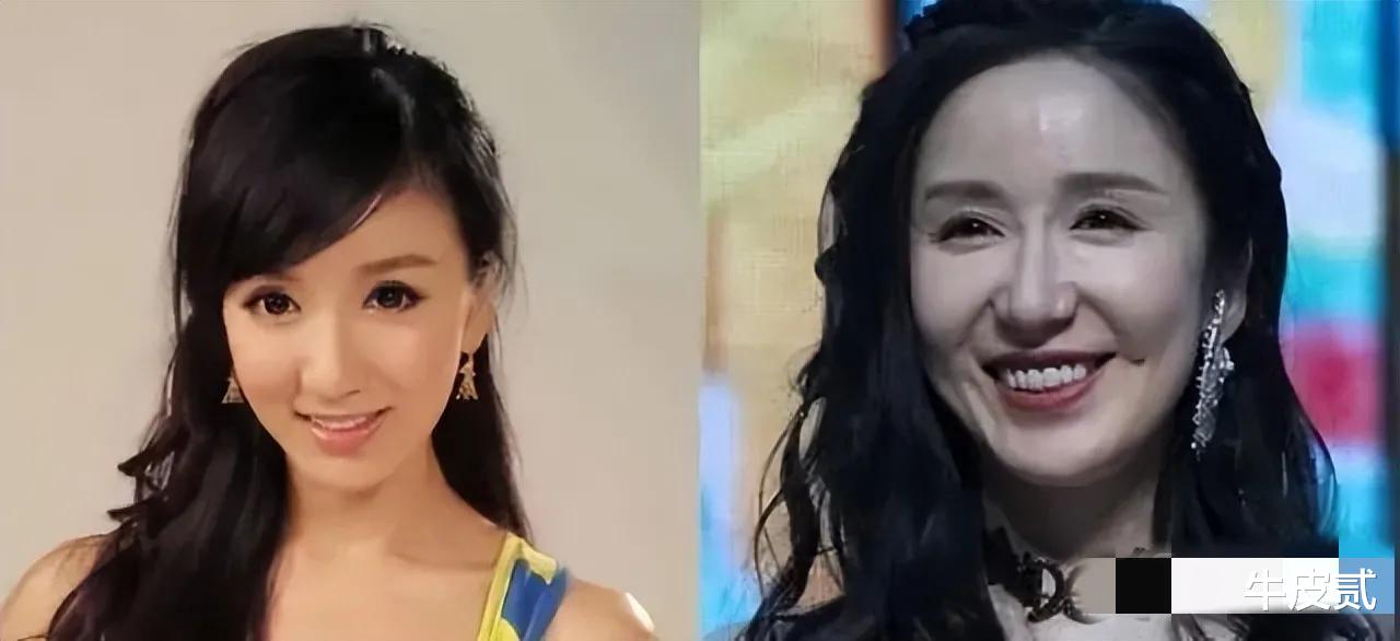 整容|有种倔强叫“我没整容”！明明从大饼脸变成V脸，真当观众瞎吗？