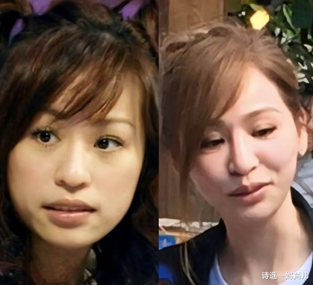 王心凌|曝王心凌生图变化大，医美脸又僵又肿，商演费52万被指捞金无下限