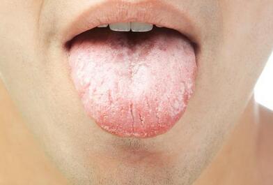 “人有三黄,寿命不长”,三黄是什么?如何对抗三黄,中医全讲了