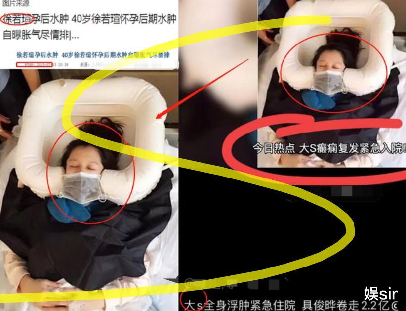 大S|3个瓜！曝大S连夜送医，王思聪45000元买狗送女友，成毅刘烨有私生子