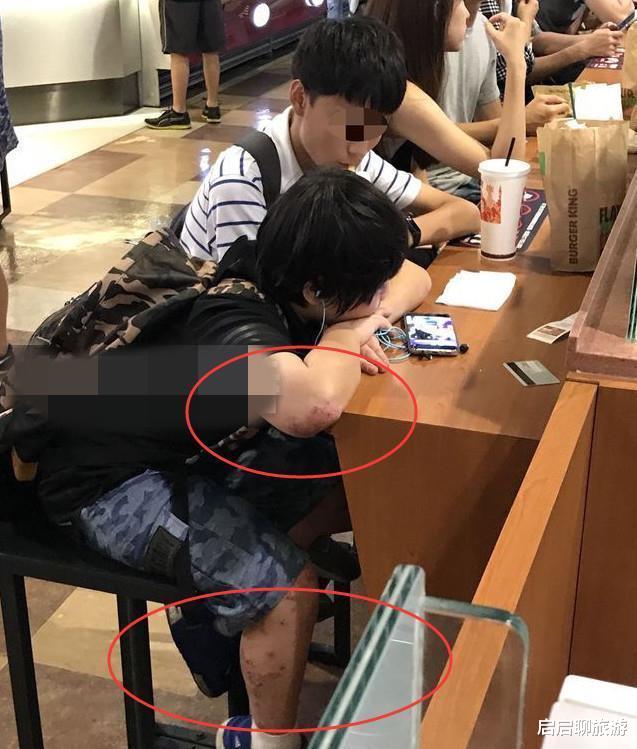 |被注射抑生长剂，身患重病被迫演出，这5位童星，被父母害惨了