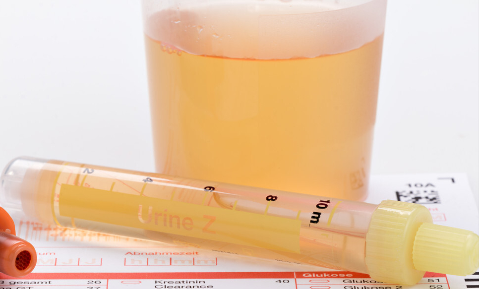 |尿酸高全身都受损,出现3种表现,可能是你尿酸高了,及时控制