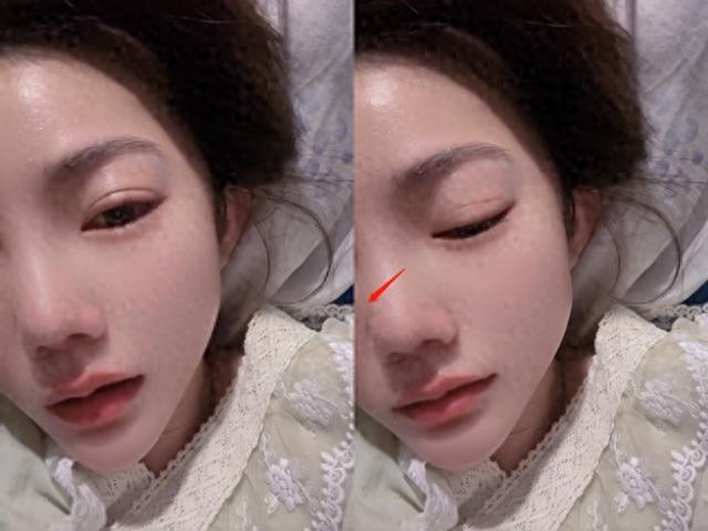 中华小姐回应牙齿被拔光,穿赵露思同款衣服摆拍,耳朵被割戴假耳