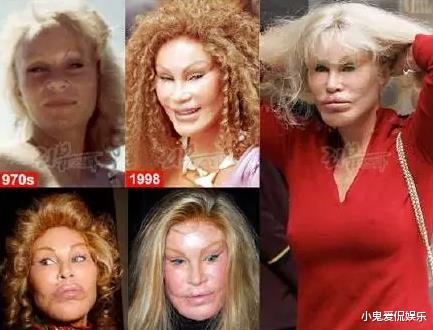 美貌名媛为讨好老公,狂砸千万整容成猫?整容“成功”后反遭抛弃