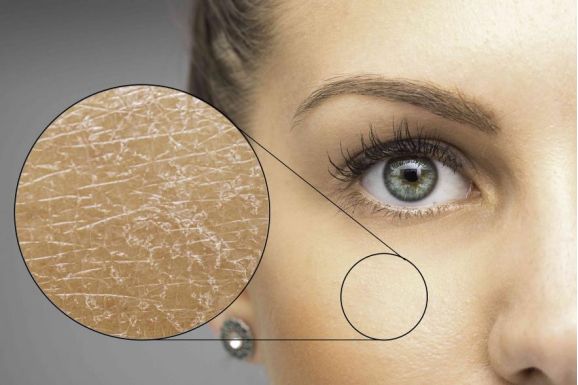 初冬扶护有一手