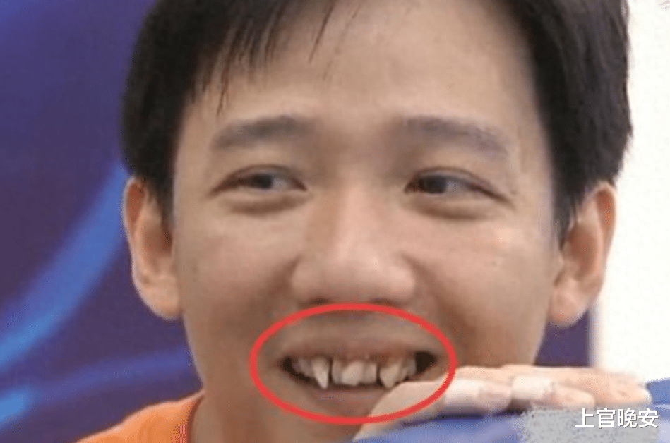 没眼看!嘴包不住牙,嘴凸,演戏难看,明星能不能放弃烤瓷牙审美