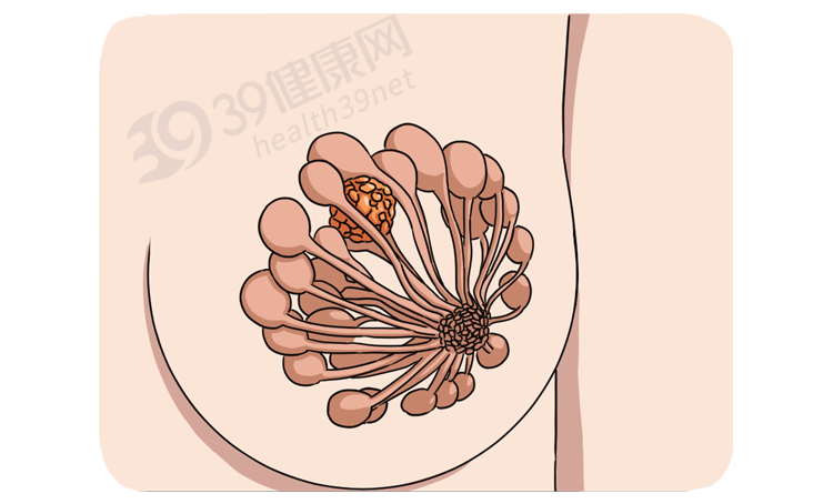 肿瘤|一针“冻死”癌细胞，被证实有效！损伤小恢复快，多种癌症可用