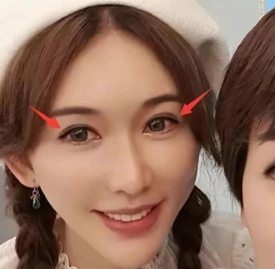 林志玲|林志玲家暴风波后生图曝出!满脸痘印,瘦成大头娃娃