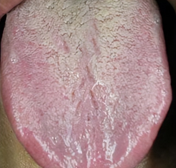 肝弱者屁多，肾弱者尿多，肺弱者汗多，4个中成药养好你的五脏