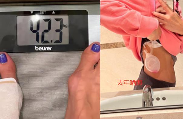 金·卡戴珊|曝李玟离婚净身出户！晒病床照透露腿出问题将开刀，体重剩42公斤