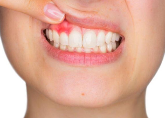 蔬菜|肝火、心火、胃火，五脏都上火怎么办？陈医生教你灭一身之火