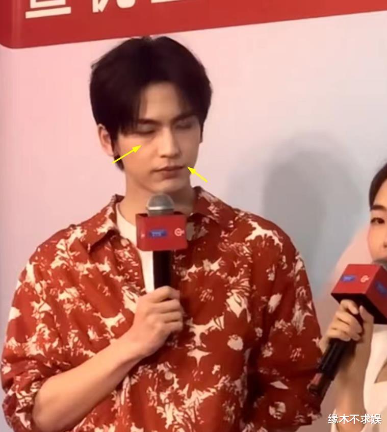 25岁张凌赫线下活动,身高190cm还穿增高鞋,生图面部崎岖不平