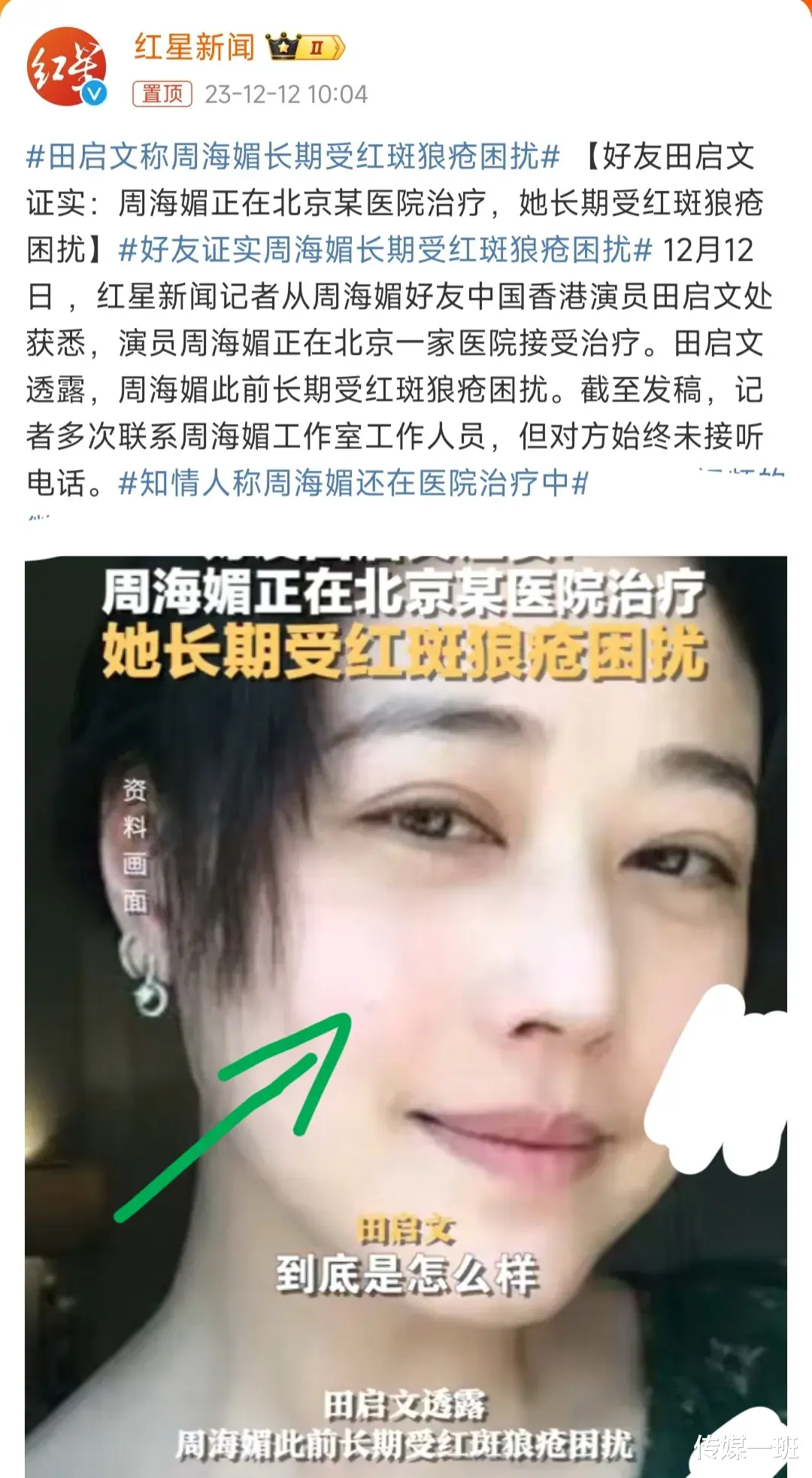 周海媚还在医院插管抢救,自媒体们却已提早宣布她的死亡,太心寒