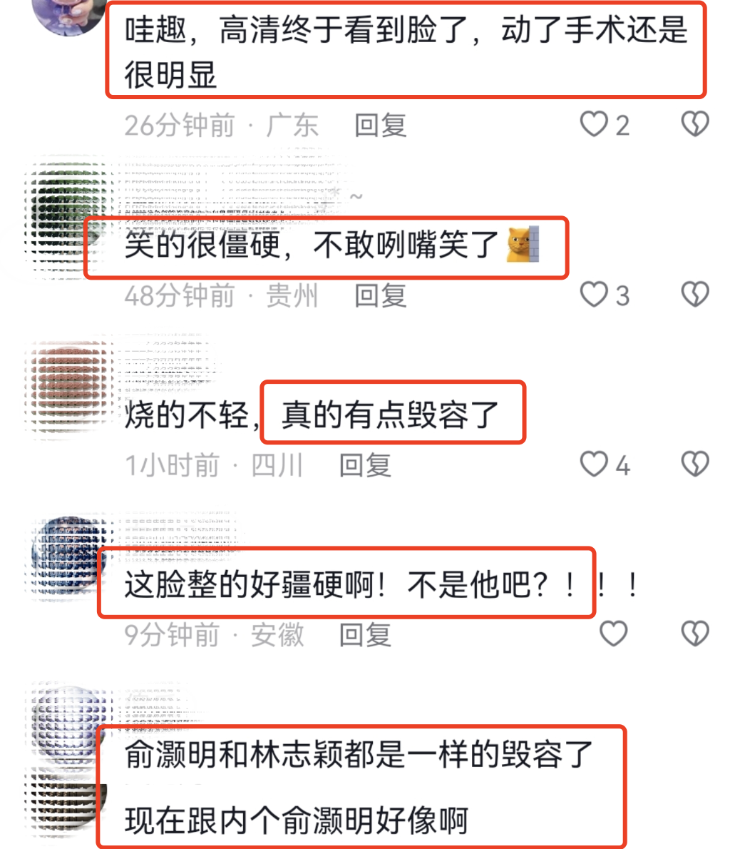 林志颖抵达长沙录《披荆斩棘》,车祸后下巴凹凸不平被指像俞灏明