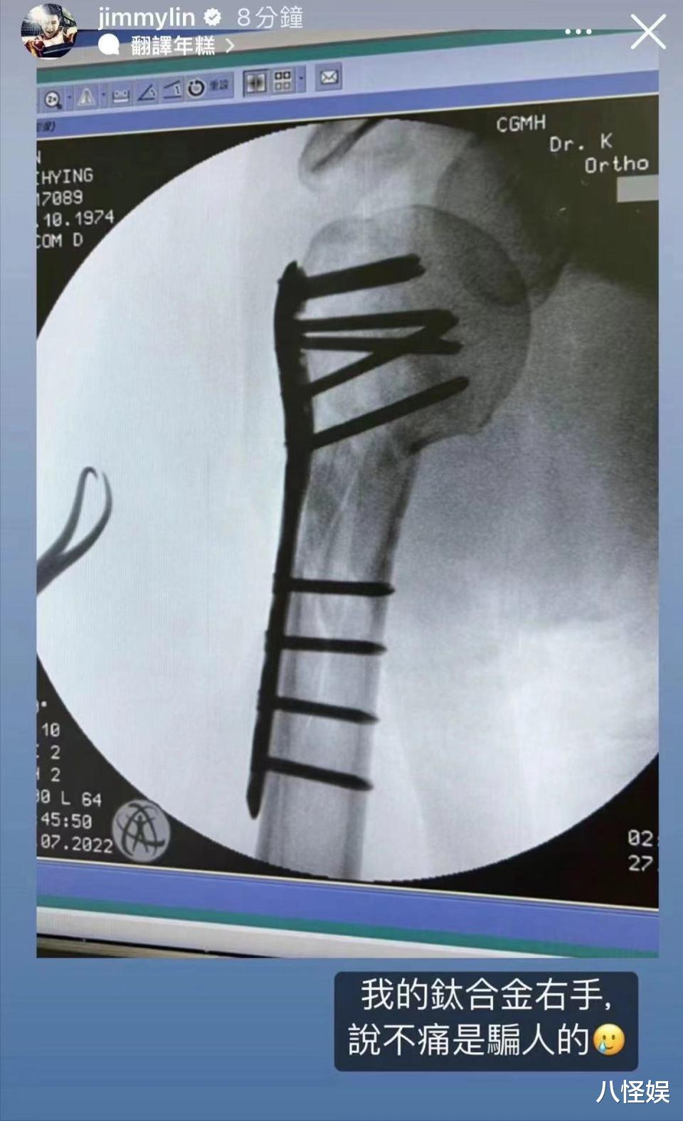 林志颖携全家度假,双子星颜值差异大!14岁Kimi久违露脸变瘦太多