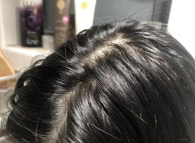 肌肤 头发经常出油贴着头皮？教你4个护发技巧，洗完干爽又蓬松