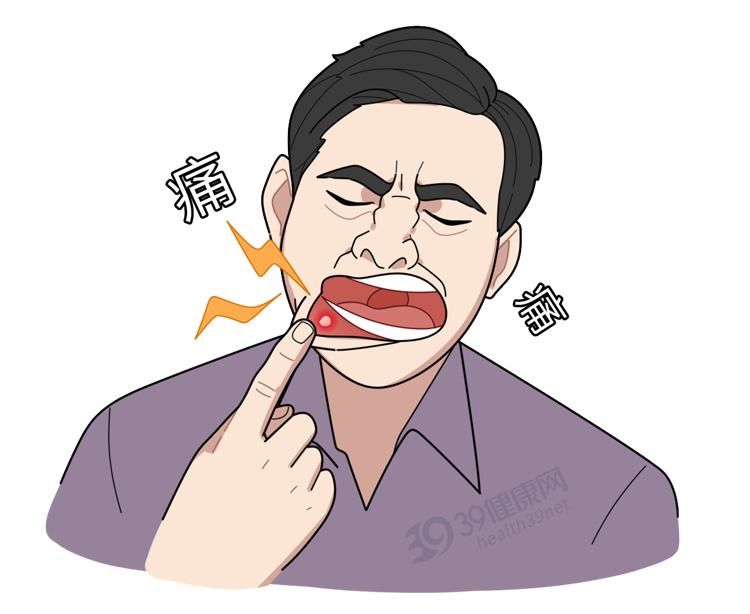 口腔溃疡|反复口腔溃疡是癌症前兆？提醒：开始癌变前，可能会有3种迹象