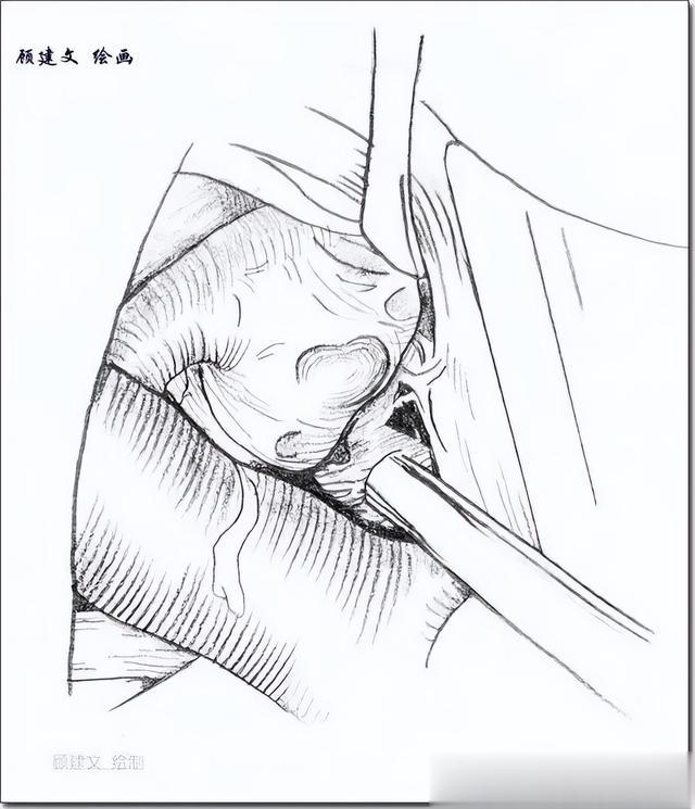 顾建文教授谈：医学绘图是外科医生的基本功