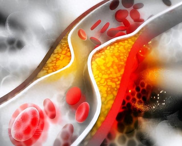 长期口服阿司匹林和阿托伐他汀，最后会怎么样呢？转给家人看看
