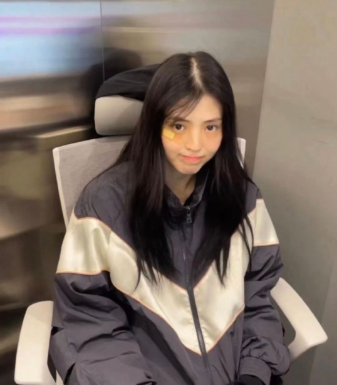 韩素希近照发缝超宽像是秃了一大块，眼神中的破碎感难掩让人心碎