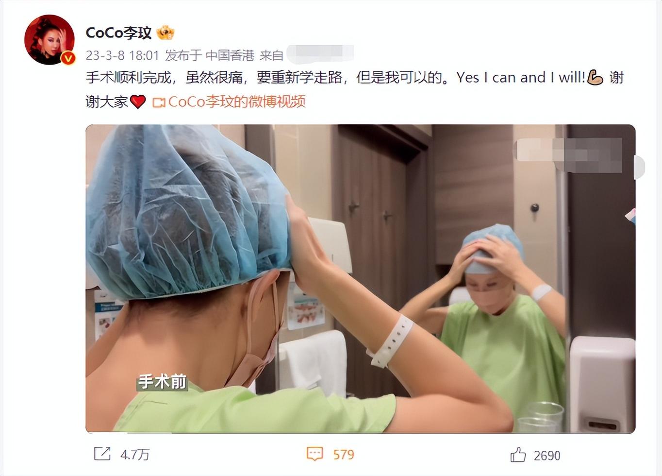 李玟|李玟术后康复训练画面曝光，靠助行器重新学走路，忍不住痛苦呻吟!