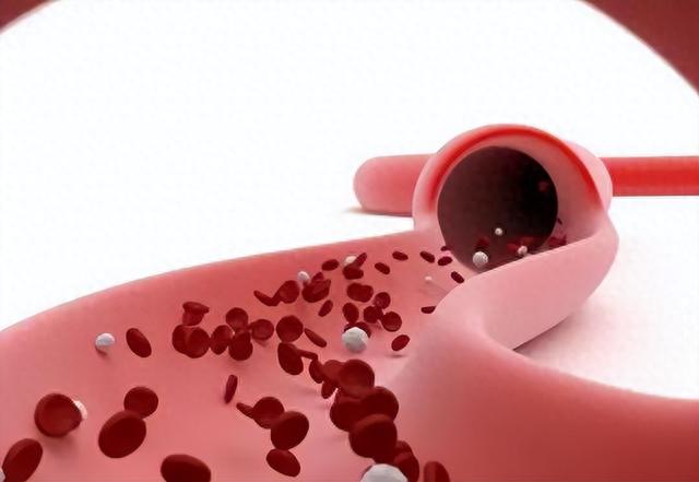 血液“稀释剂”被发现,柠檬水落榜,医生:坚持喝血管变通透