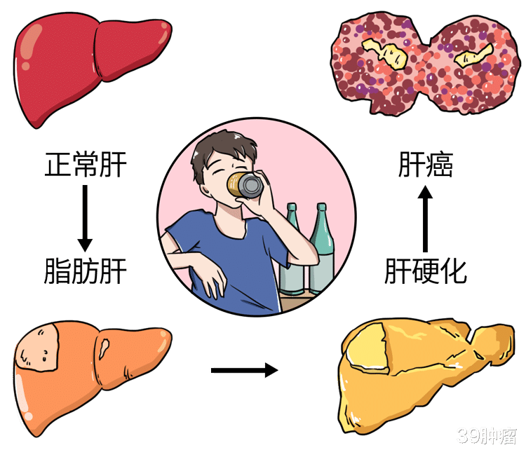 脂肪肝|每天慢走1万步，能消除脂肪肝吗？提醒：这样锻炼，效果可能更好