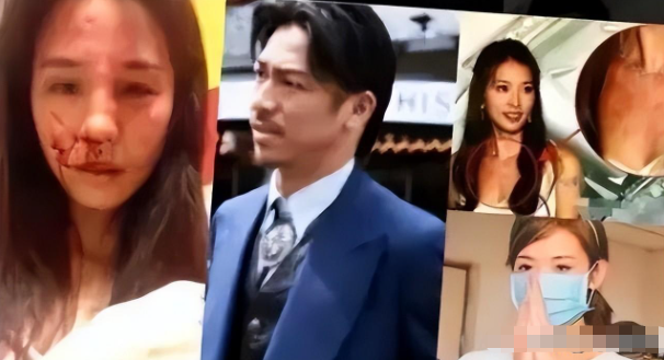 台媒曝林志玲被家暴实锤！假体被打碎返台修复，患抑郁症自杀被救