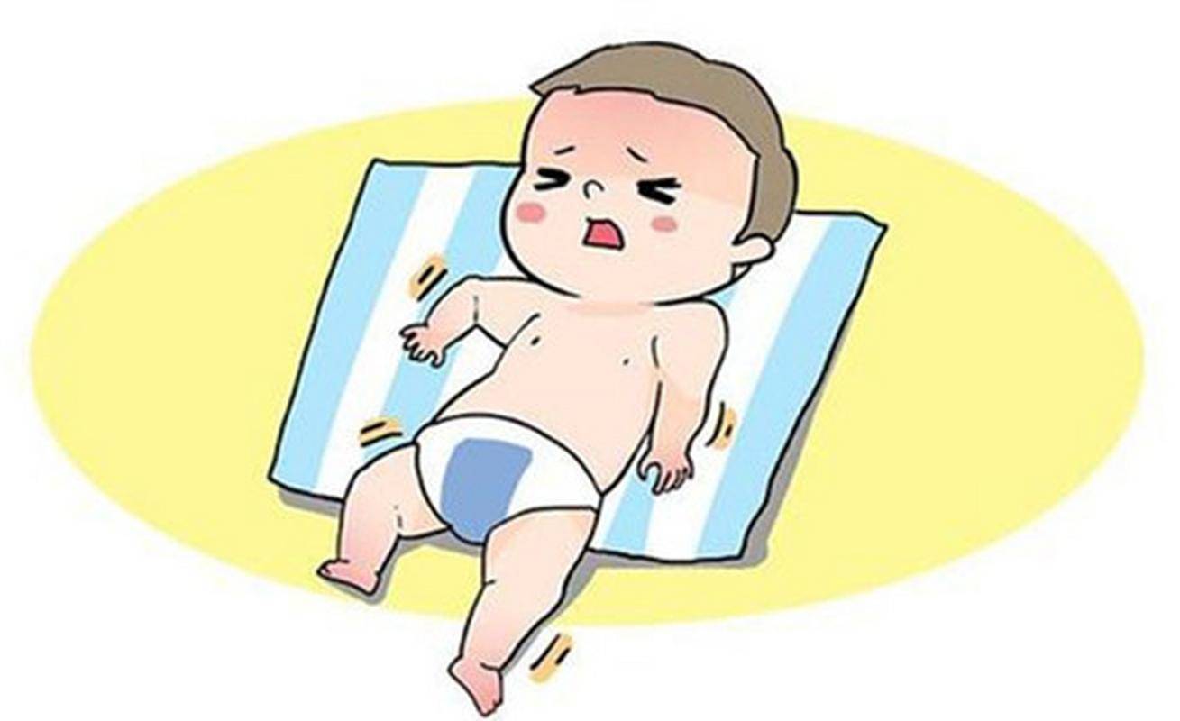 婴儿痉挛症图片图片