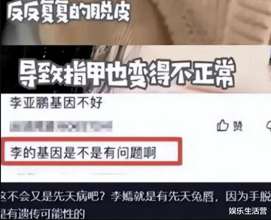 李亚鹏女儿被传基因病,金喜称会用命保护,怒斥造谣者:不配做人