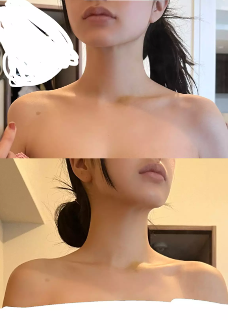 女人味|普通女生减肥后能变多美？她晒2张图震惊570w网友：仿佛换了个人