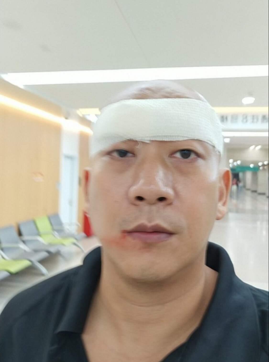 突发!TVB男星李嘉内地拍戏突发意外,坦言是老天眷顾!