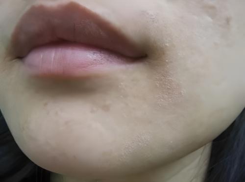 揭秘护肤界谎言:想要皮肤好,就要多补水?