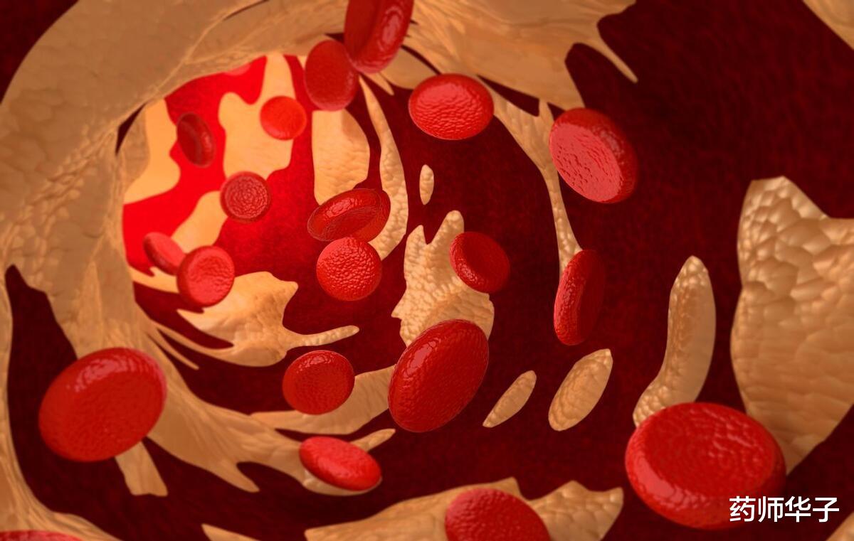 舒张压（低压）高，收缩压（高压）正常，选药时注意什么？