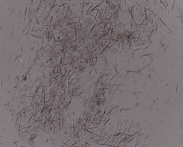 痛风饮食:哪些食物可以帮助你,哪些要避免?