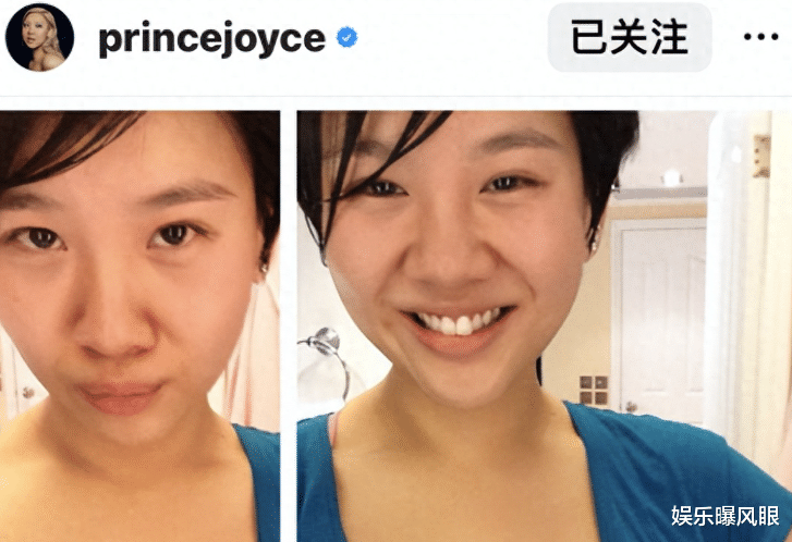 郑欣宜抑郁失踪后晒自拍!瘦到90斤腋下汗湿,剪短长发引人心疼