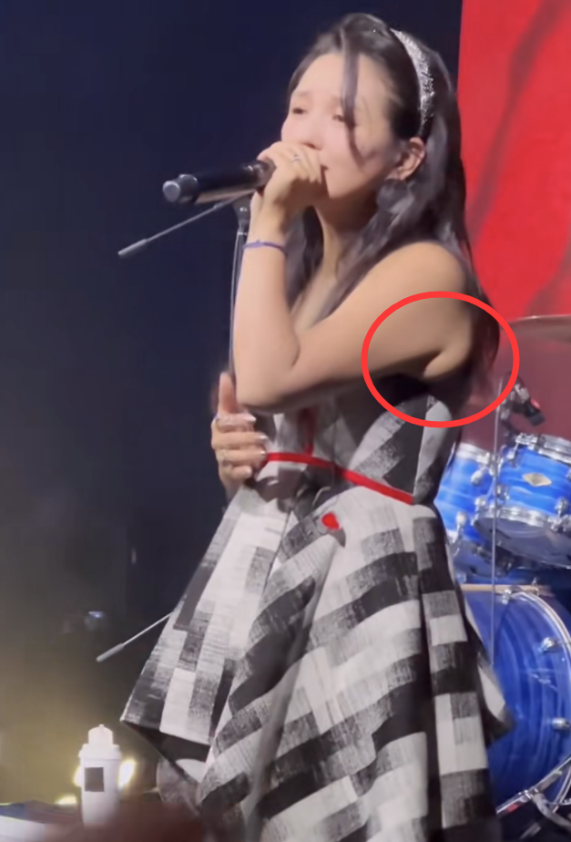 何洁暴瘦70斤现身大变样，下巴奇怪疑整容，腋下还多出一坨肉