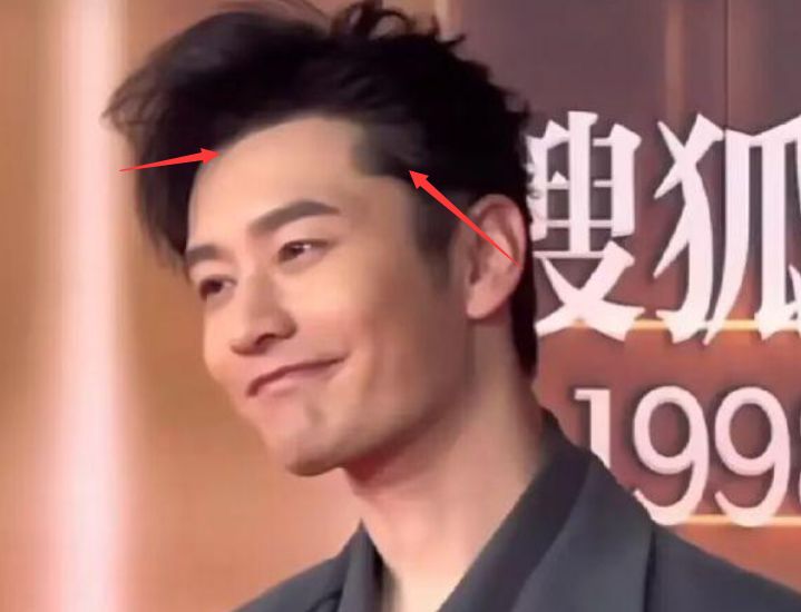 林峰|43岁林峯私下生图曝光,发际线后移秃顶明显,节目戴假发片惹争议